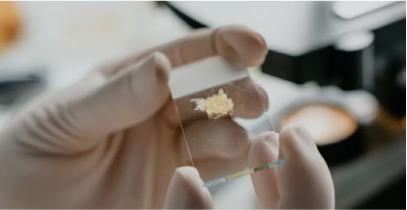 The Natural Advantage: Akay Bioactive Redefining Health and Beauty